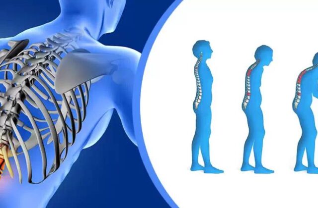 Osteoartrit Nedir Belirtileri Nedenleri ve Etkili Tedavi Yöntemleri