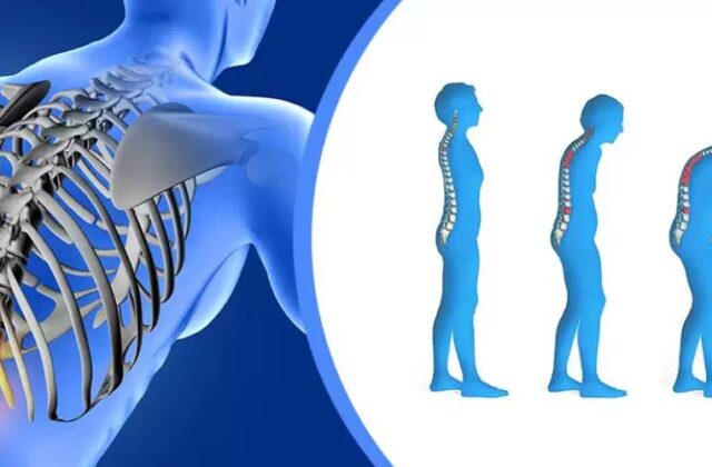 Osteoporoz Nedenleri, Belirtileri ve Tedavi Yaklaşımları